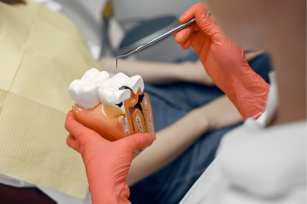 Root Canal Treatment in Sector 38, Chandigarh | Dr. Dipti Bhatnagar