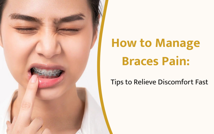 How to Manage Braces Pain: Tips to Relieve Discomfort Fast