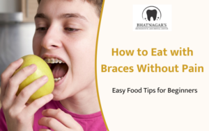 How to Eat with Braces Without Pain: Easy Food Tips for Beginners