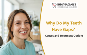 Why Do My Teeth Have Gaps? Causes and Treatment Options