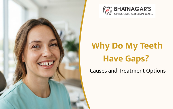 Why Do My Teeth Have Gaps? Causes and Treatment Options