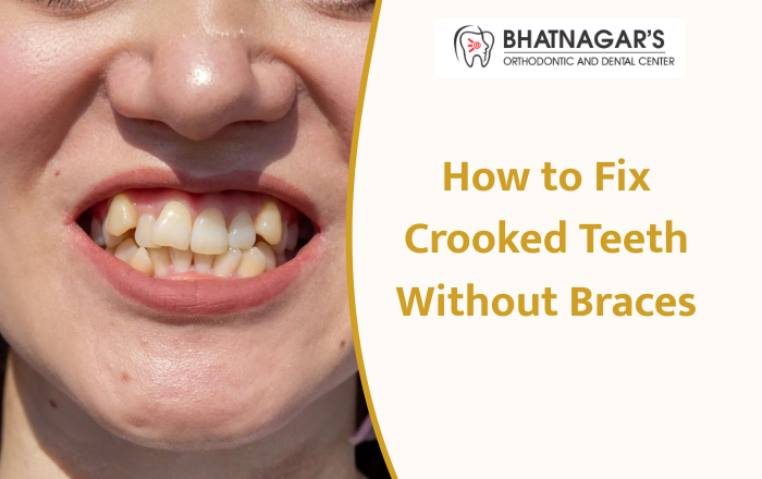 How to Fix Crooked Teeth Without Braces